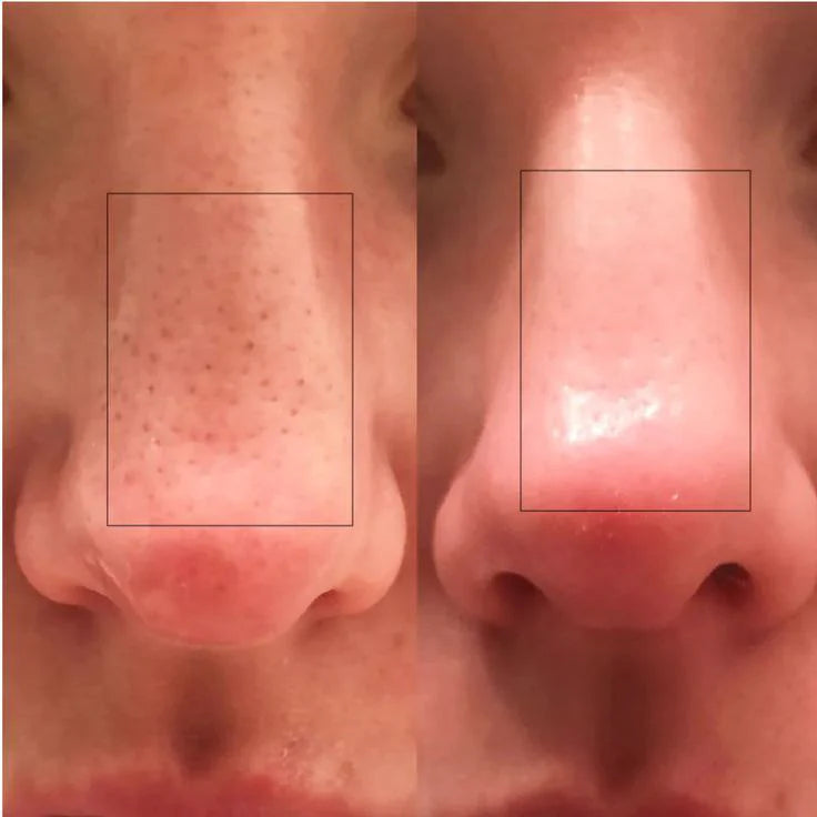 Dr. Melaxin™ – Glass Skin Premium Kit (6 pcs)