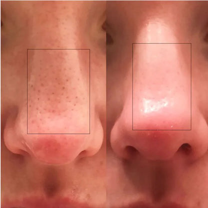 Dr. Melaxin™ – Glass Skin Premium Kit (6 pcs)